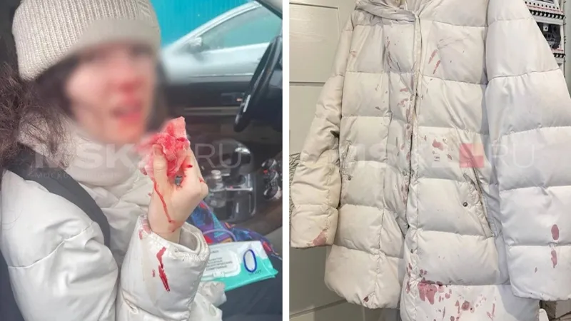 Школьница травмировала нос из-за гололеда в Химках. Власти ответили на обвинения