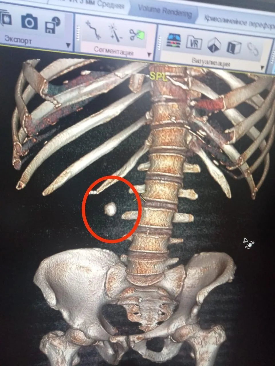 Балашихинская больница