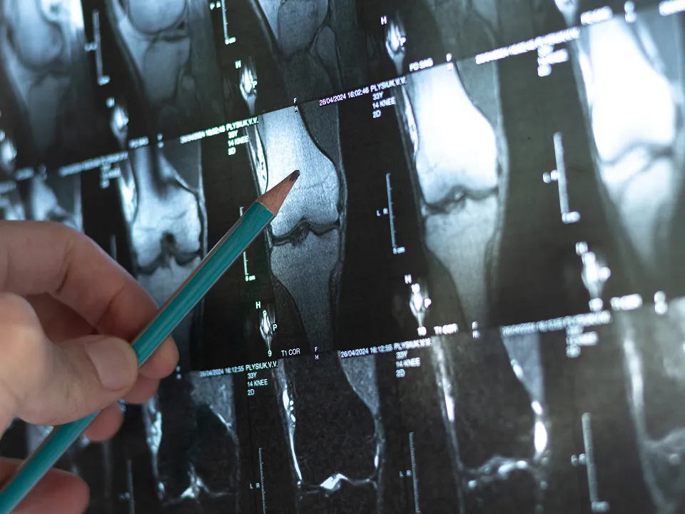 Фото: istockphoto.com/Vadym Plysiuk