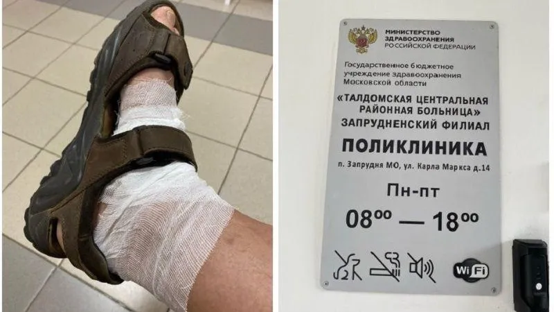 Мужчина, наступивший на ржавый гвоздь, восхитился работой медиков в поселке под Талдомом