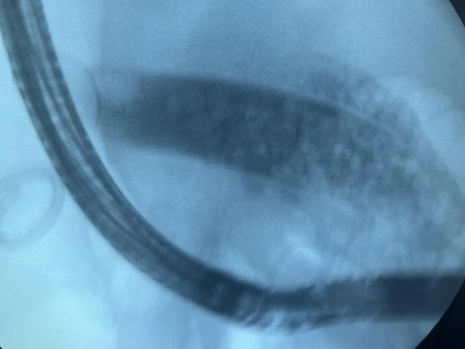 Фото: ГБУЗ МО «ПОКБ»