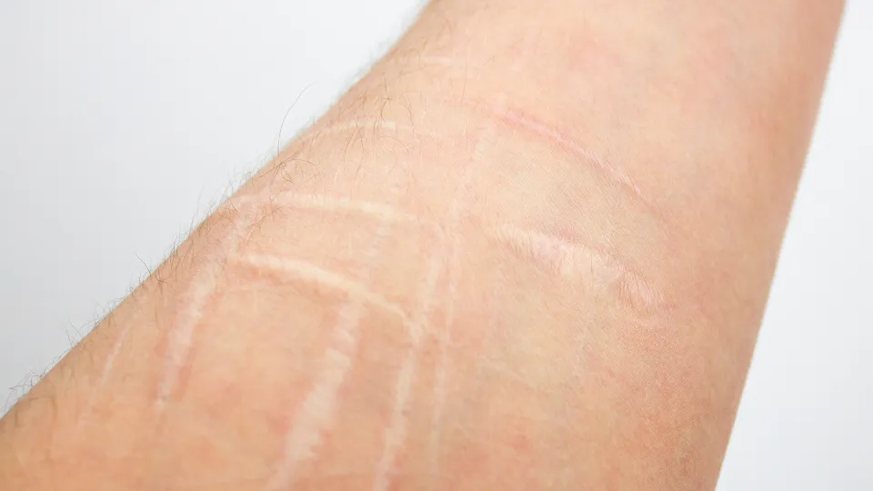 Фото: istockphoto.com/bin kontan