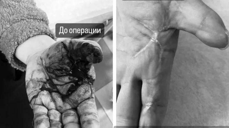 © Пресс-служба Министерства здравоохранения Московской области