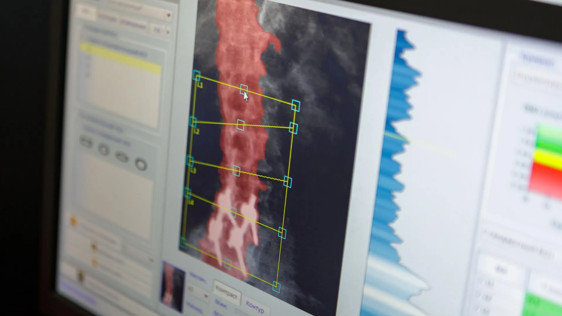 Люберецкая областная больница, Наталья Лымарь
