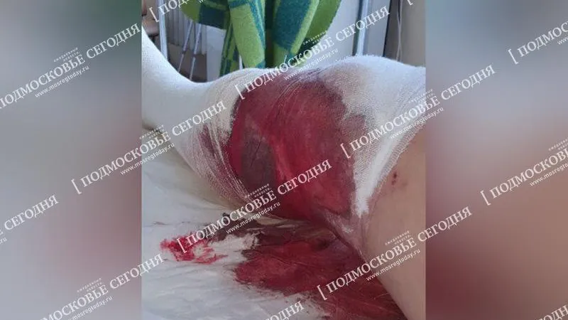 Раздробленное колено вместо трапезы получил постоянный клиент ресторана Химок