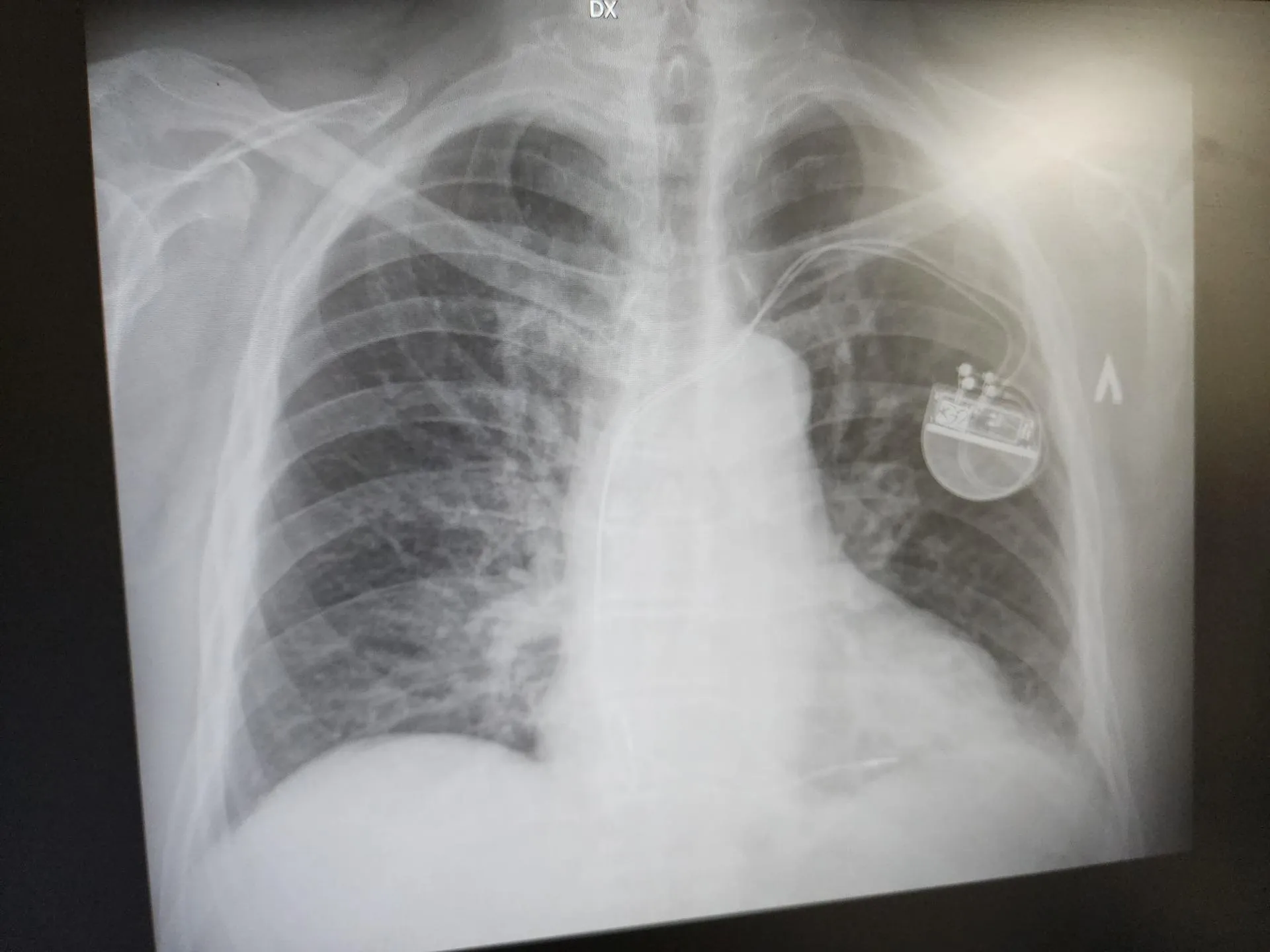 Фото: МедиаБанк Подмосковья/Юлия Унрау