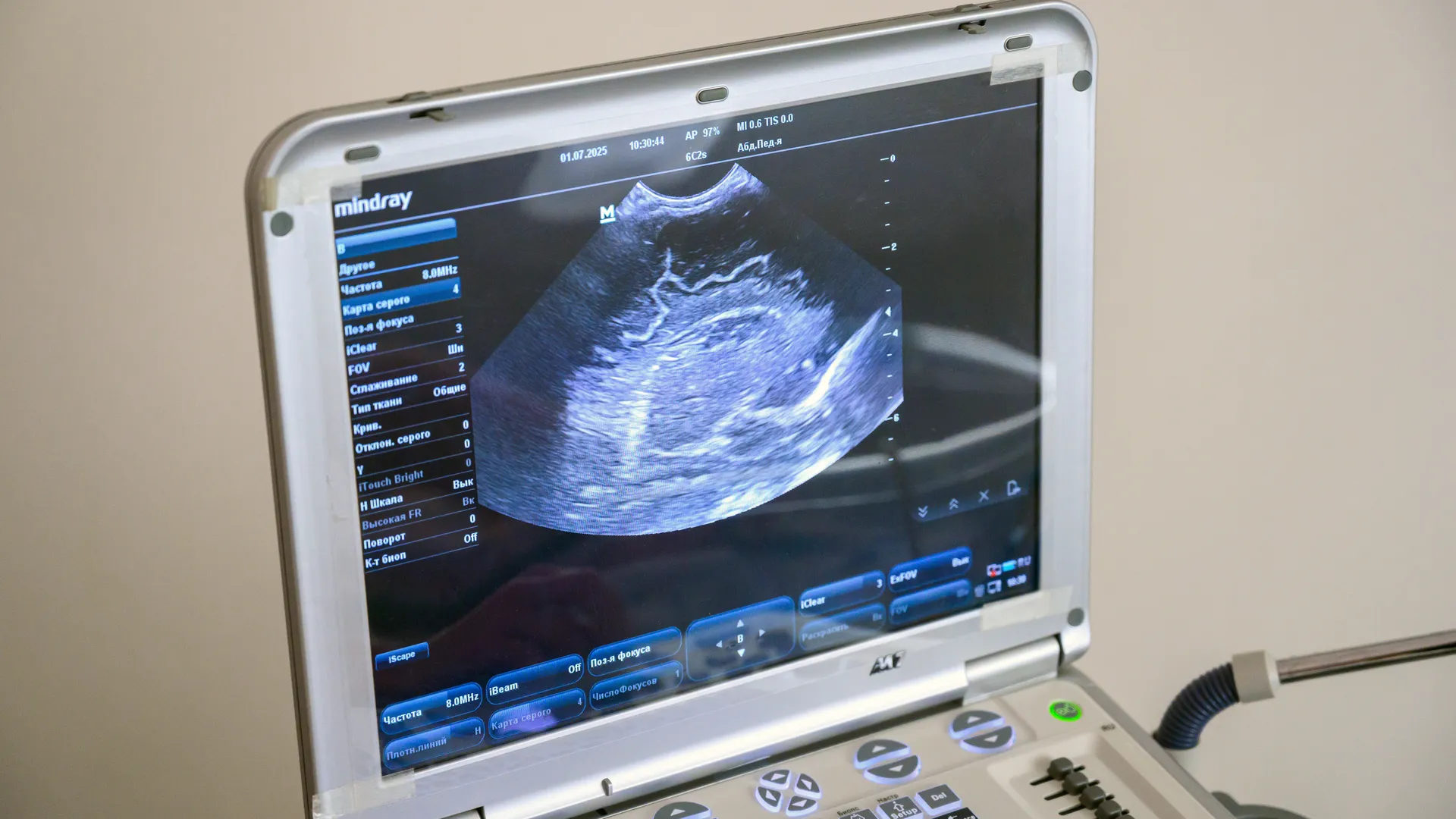 Беременные мужчины и мертвые пациенты: абсурдные цифры выявили в финансировании больниц Казахстана