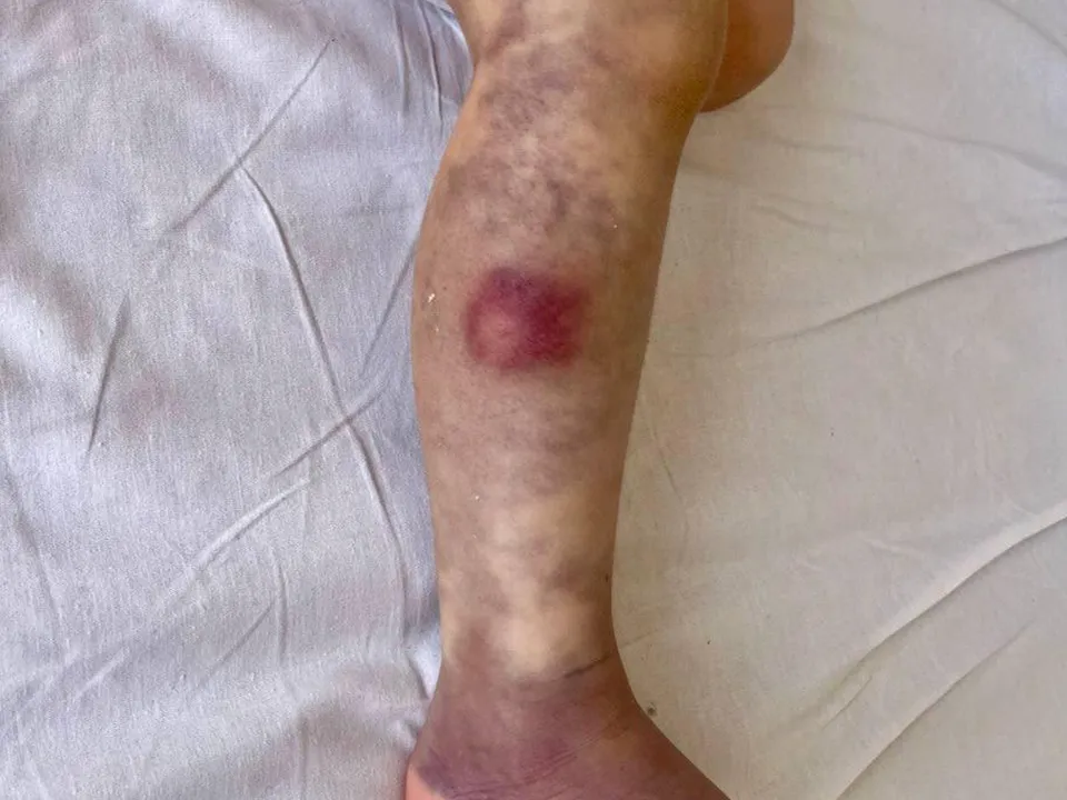 Фото: МОЦОМД