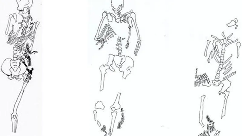 International Journal of Paleopathology