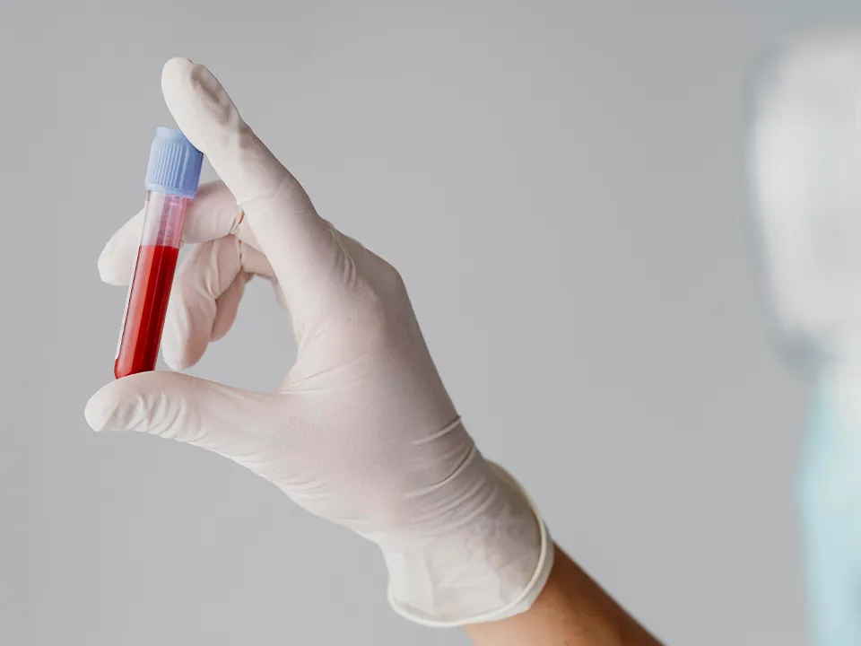 «Он был у ребенка»: эпидемиолог рассказала о редком случае бытового заражения сифилисом