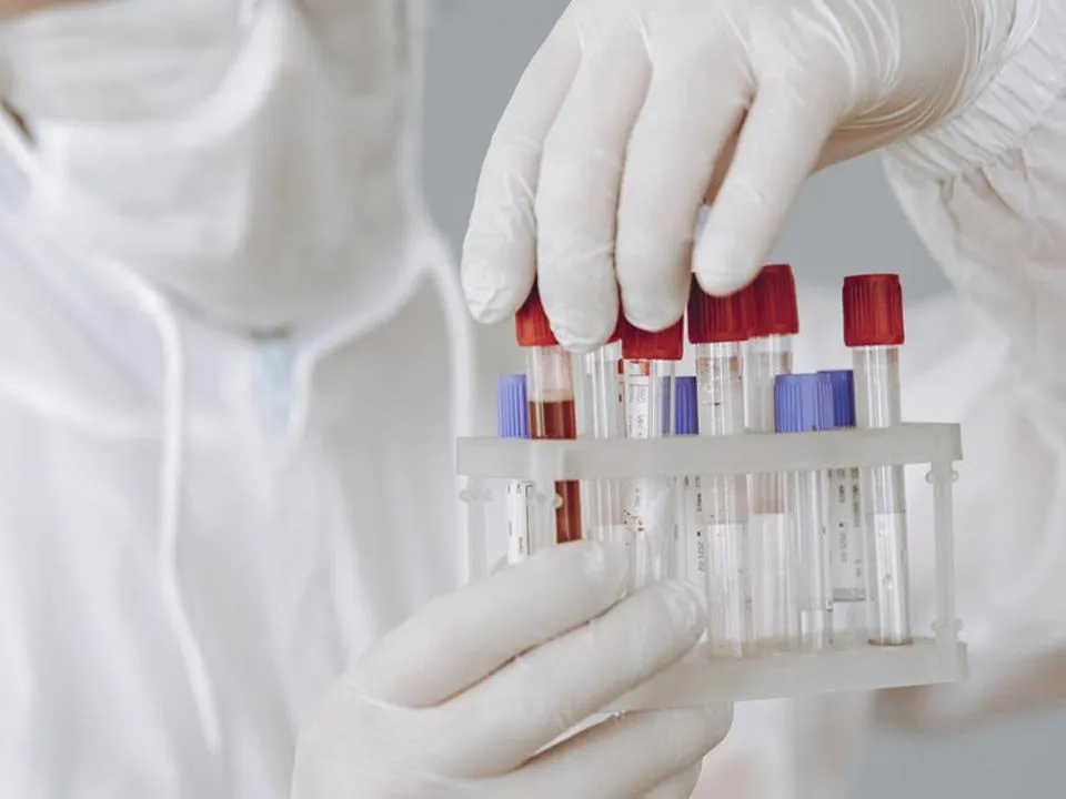 «Период безмятежности подошел к концу»: выяснилось, чем грозит человечеству новая пандемия чумы