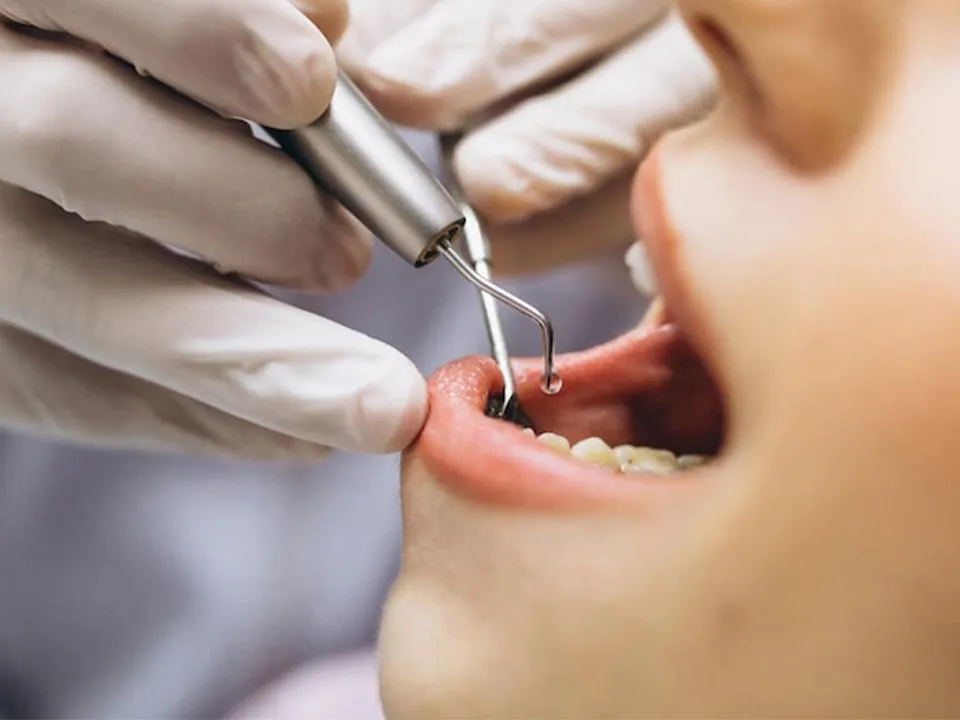 «Проще предотвратить, чем вылечить»: стоматолог рассказала, как избежать проблем с зубами