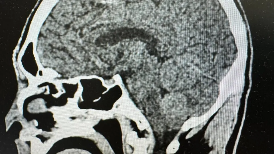 Фото: пресс-служба Долгопрудненской ЦГБ