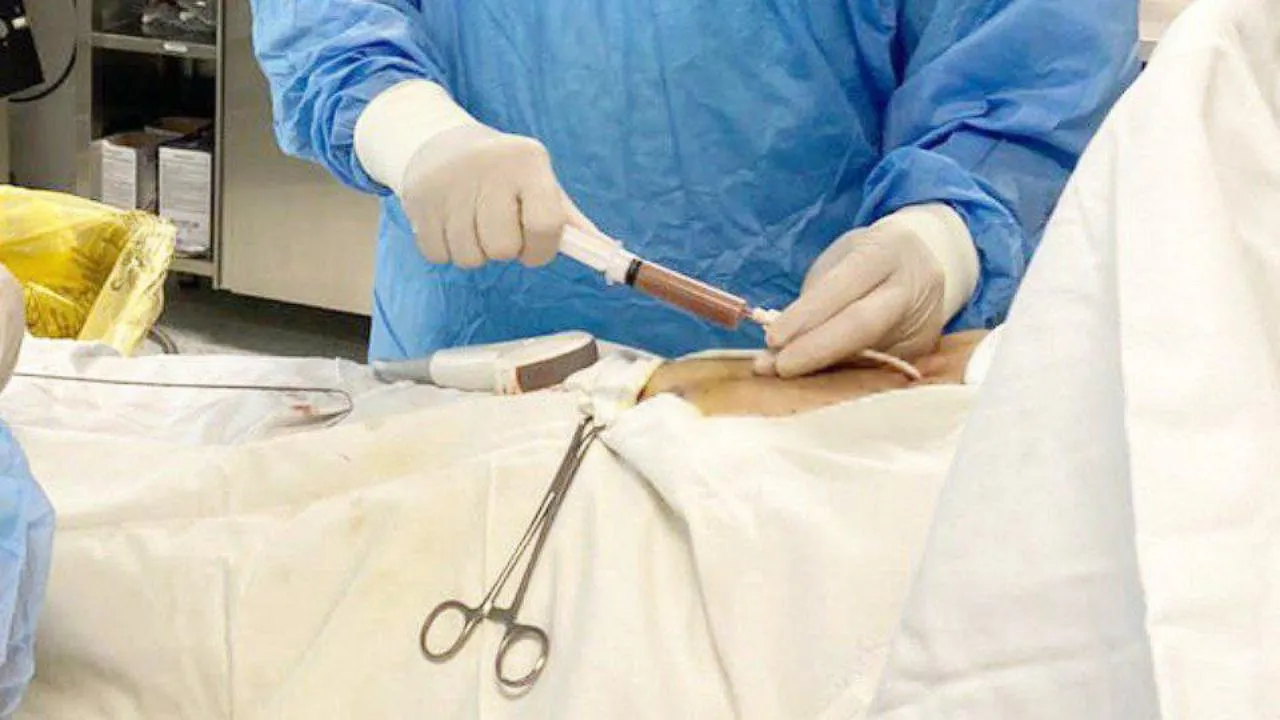 Пожилую женщину, у которой обнаружили кисту печени, прооперировали в Раменском