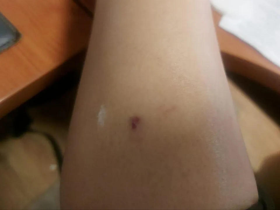 Фото: предоставлено мужем пострадавшей Кириллом&nbsp;