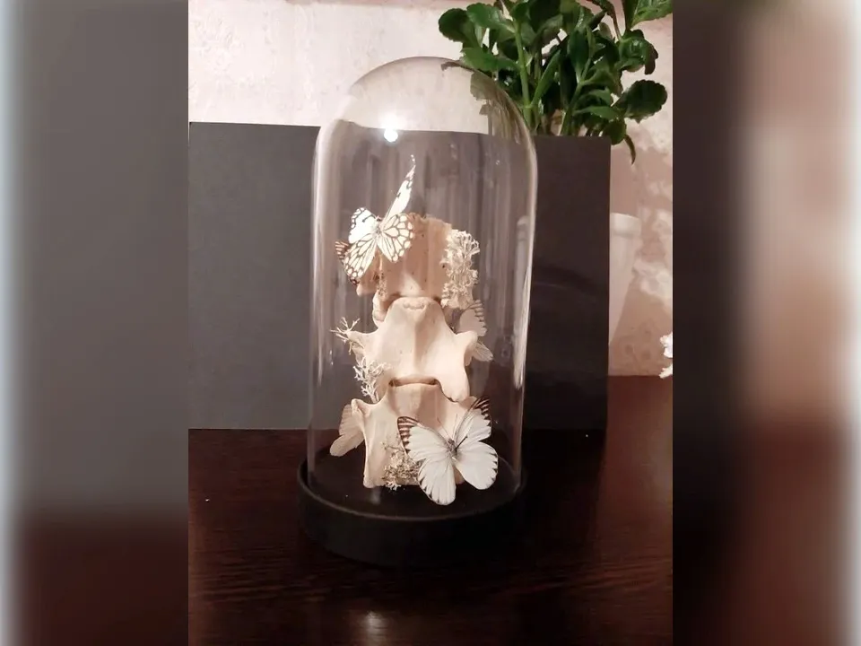 Бабочки на позвонках