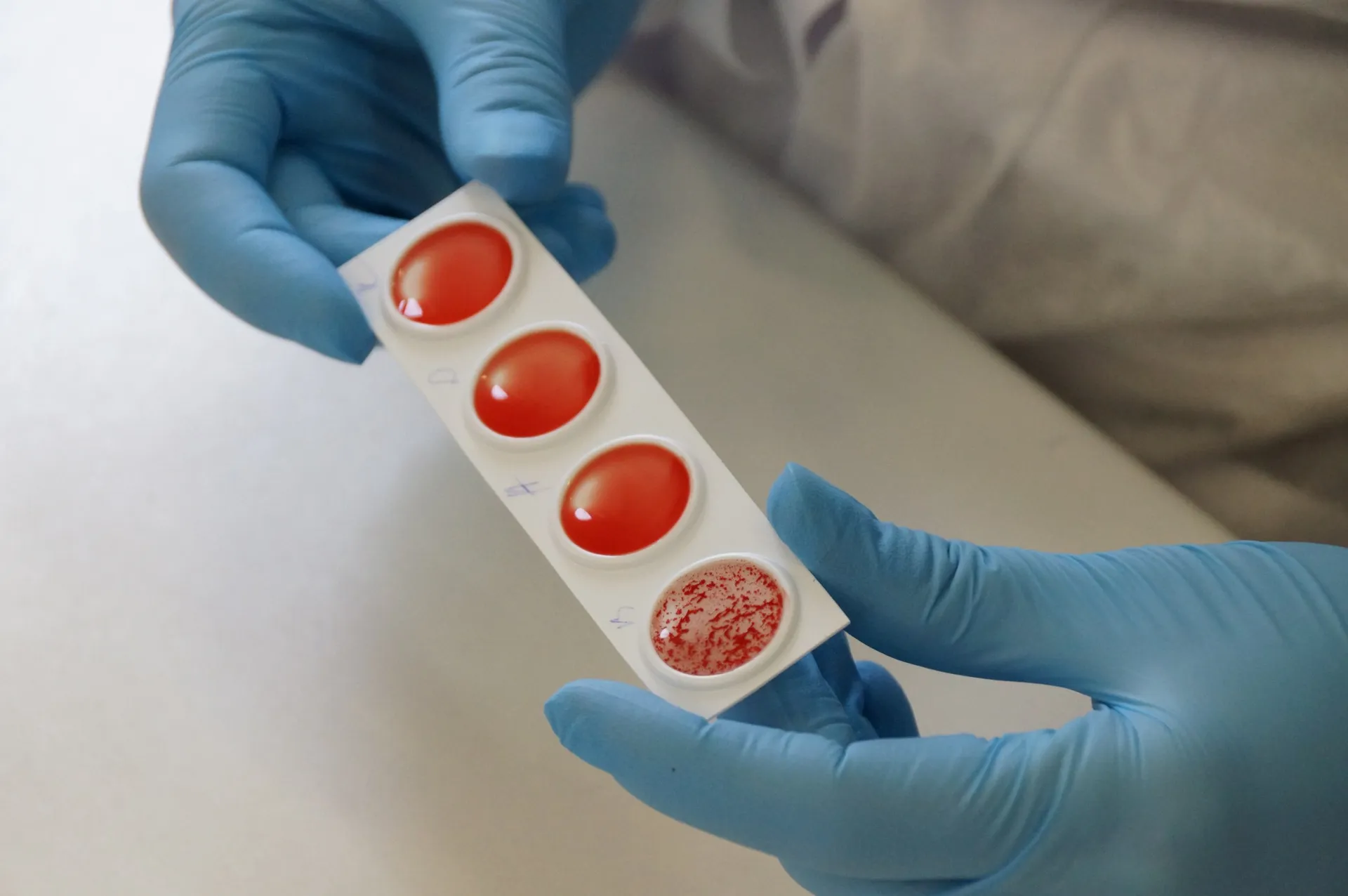 Фото: Служба крови ТГ-канал