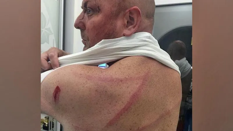 Правосудия для своих обидчиков ждёт мужчина, избитый под Сергиевым Посадом за символику спецоперации