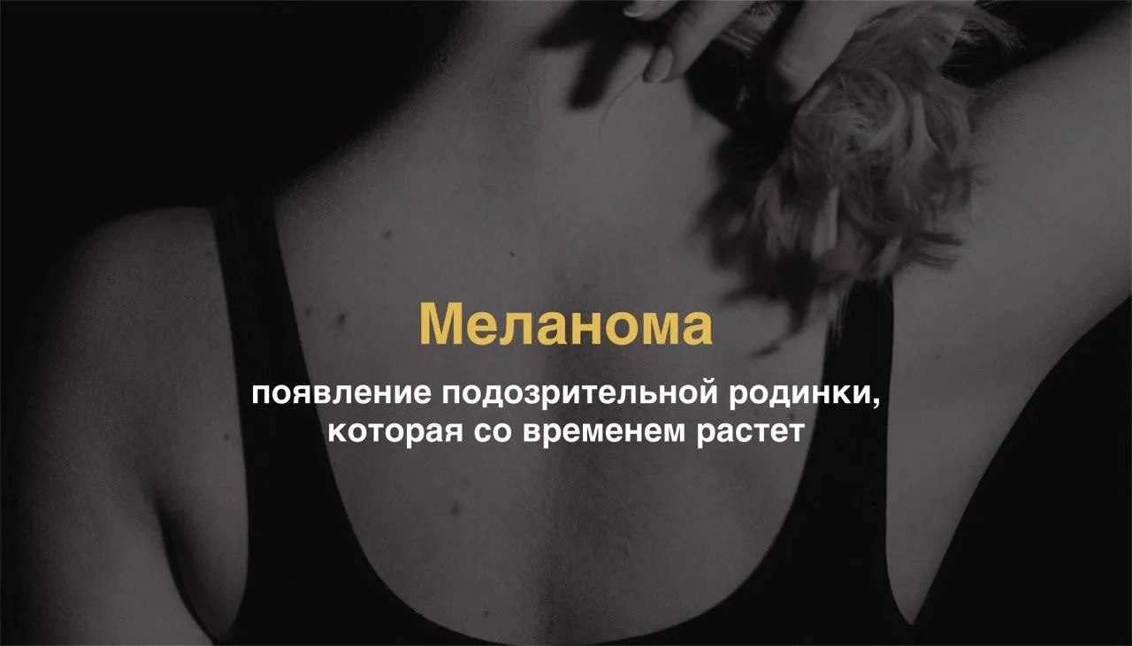 Коллаж: Unsplash