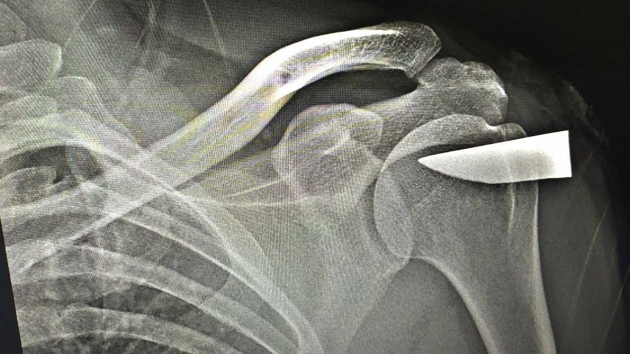 фото:Telegram-канал "Осторожно, Москва"