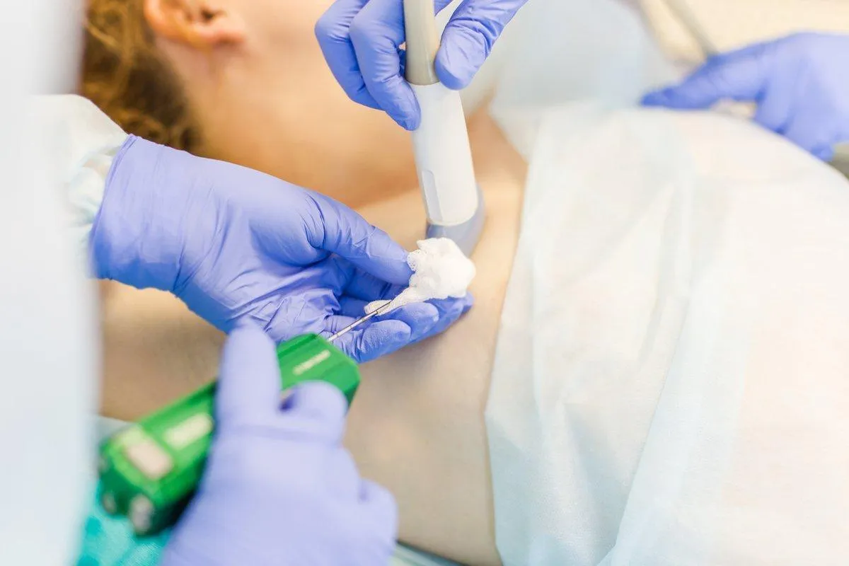 Из архива Одинцовской больницы / Проведение биопсии