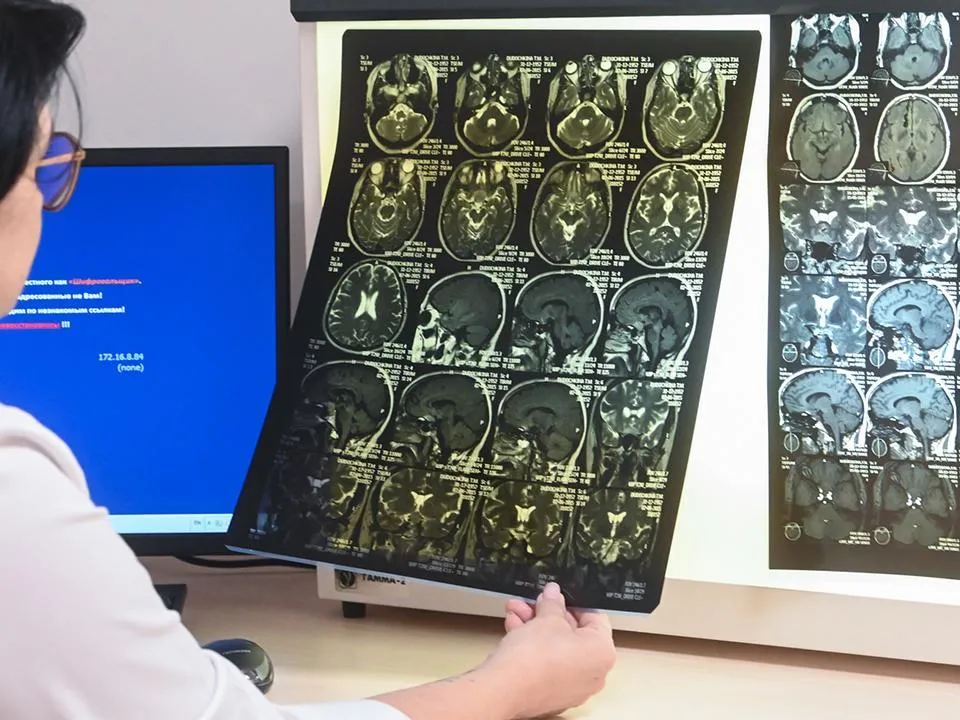 «Присмотритесь к гранату»: врач рассказала, как можно уменьшить риски инсульта