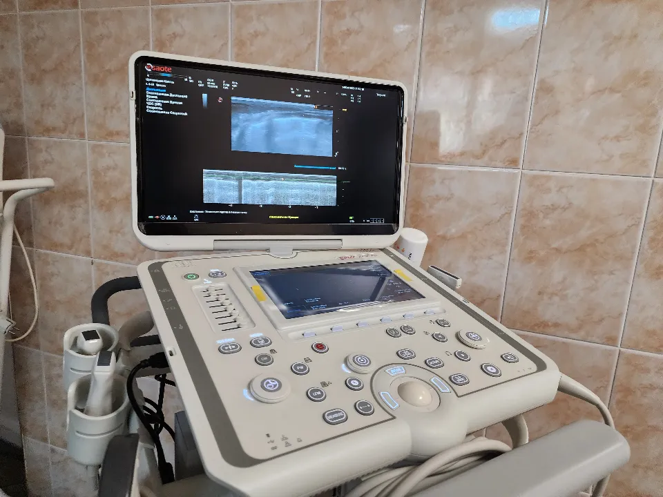 Аппарат УЗИ. Фото: МедиаБанк Подмосковья/Мария Шигорева