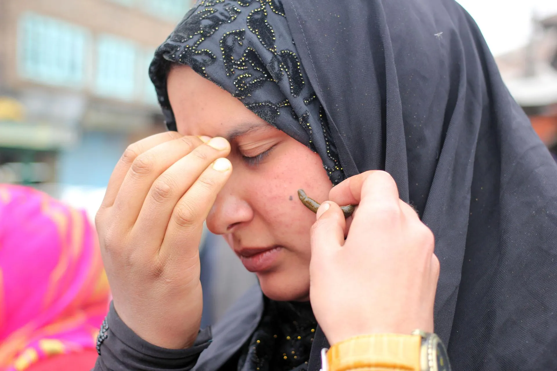 Фото: India: Leech Therapy In Kashmir / ZUMAPRESS.com