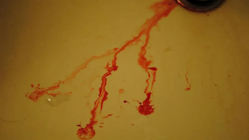 Вор после отсидки порезал сожительницу в Чеховском районе