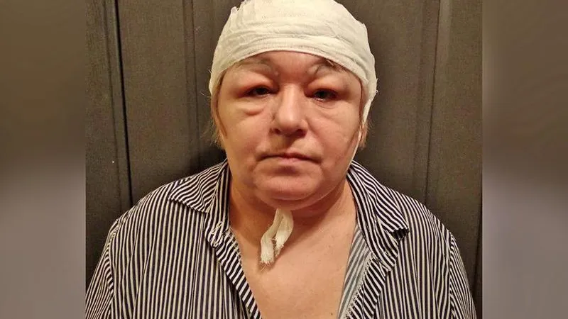Врачи Рузы проворонили абсцесс на голове пациентки
