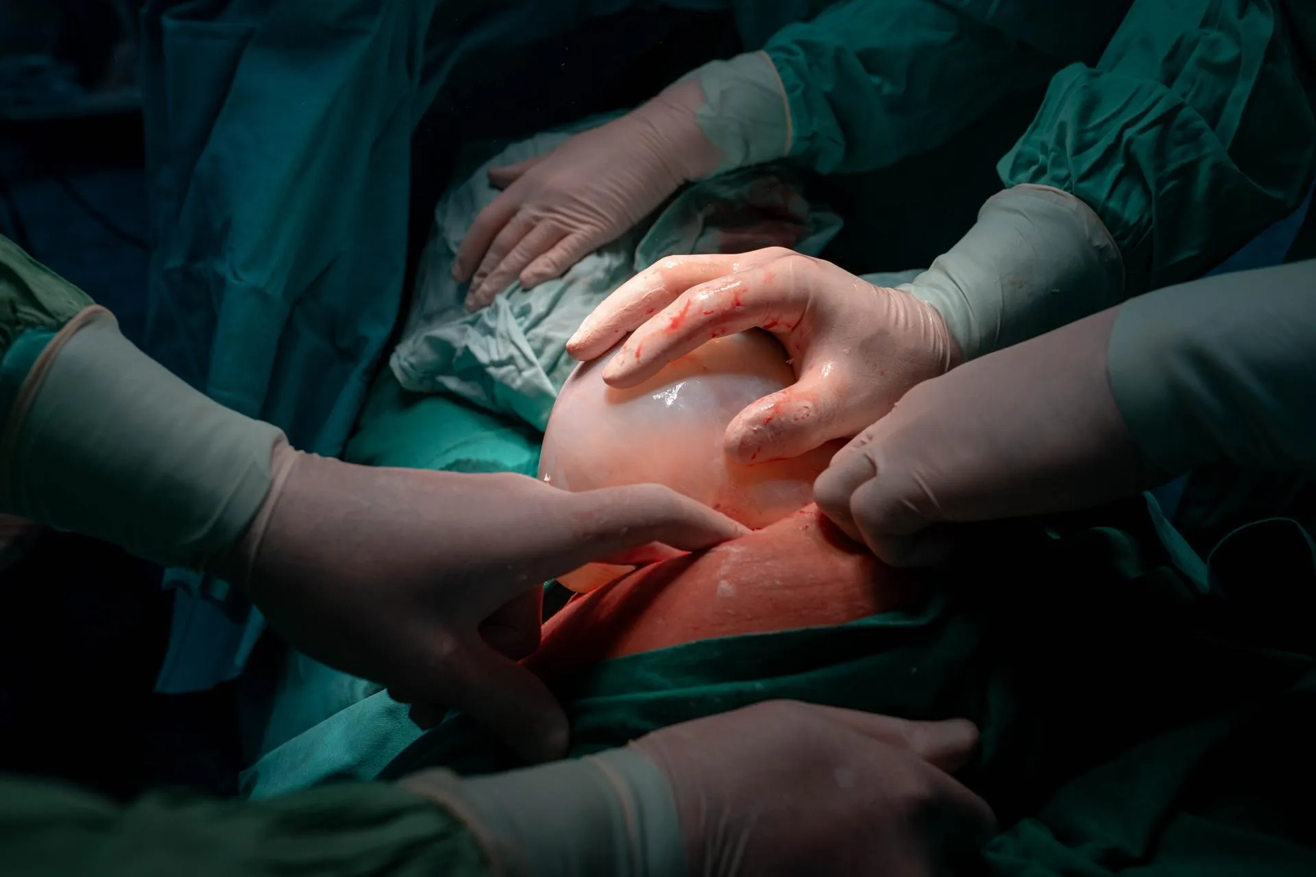 Щелковский перинатальный центр